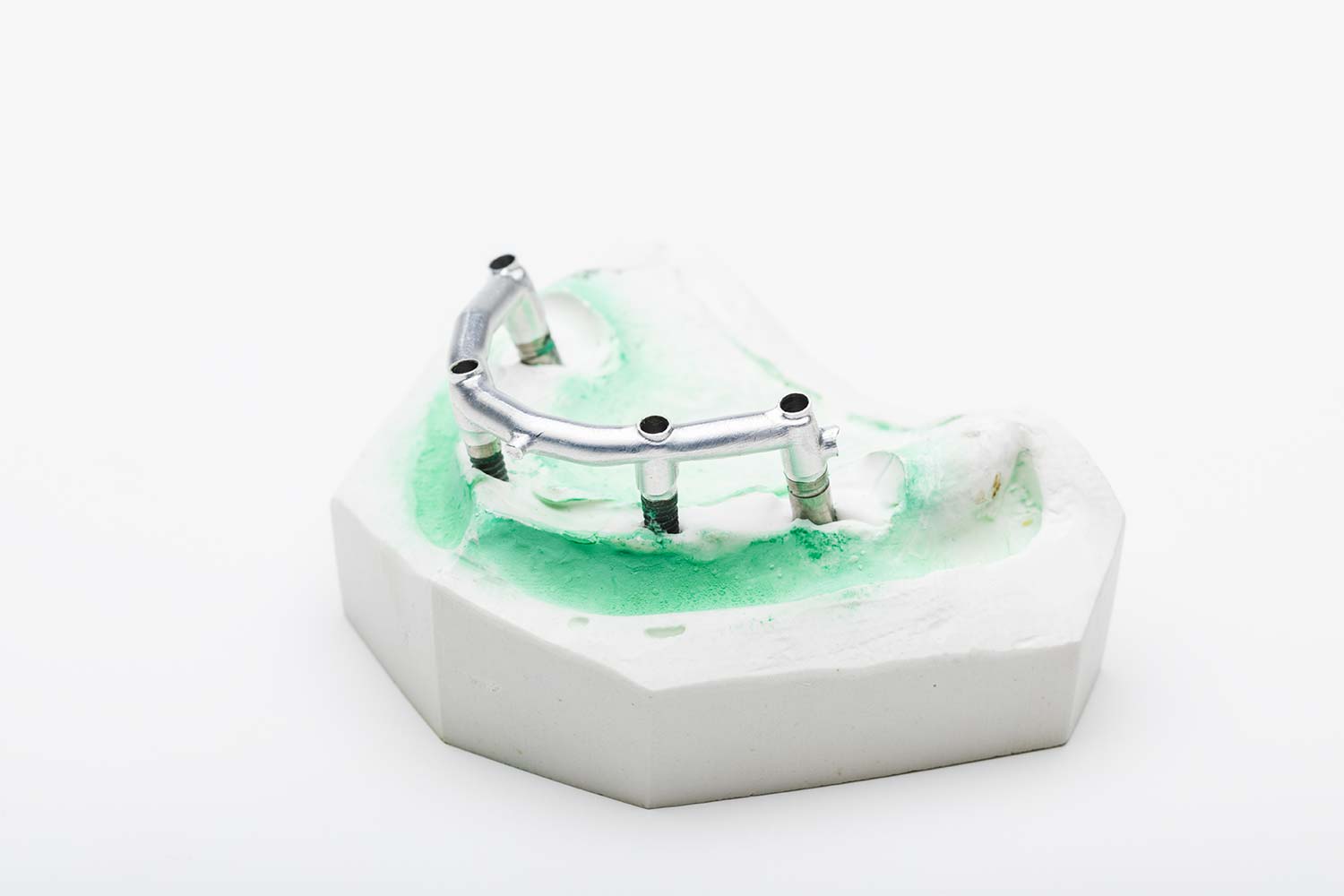 Agliati Implantologia | Custom Made in CAD CAM