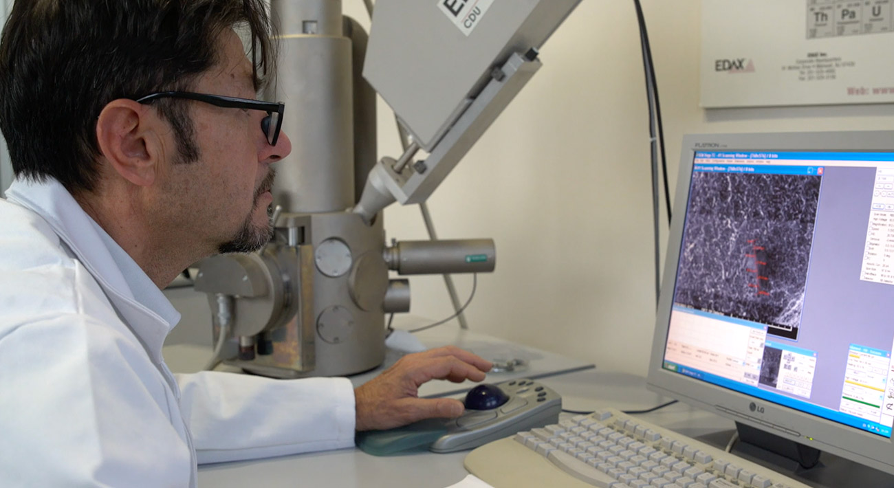 Agliati Implantologia | Microscopio a scansione elettronica